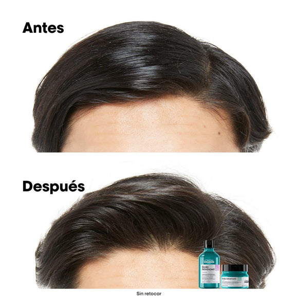 SHAMPOO ANTI GRASA L'ORÉAL PROFESSIONEL SCALP 300ML LOREAL CAPILAR
